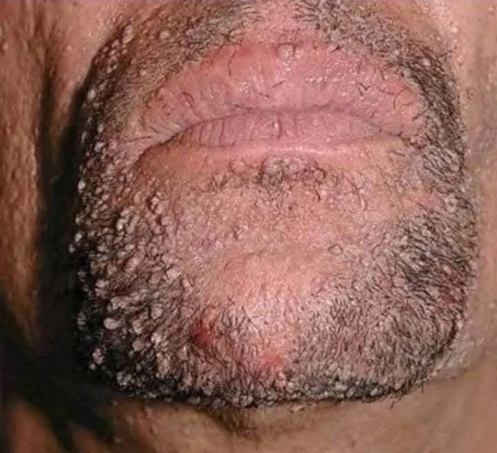 Your Health & Reality® Infectious Disease & The Beef Jerky Effect in Western Conventional Medicine & Their Cures